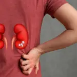 Prurito diffuso e calcoli renali: il collegamento poco noto tra sintomi cutanei e salute dei reni