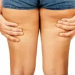 Slimdren Plus, le recensioni di chi ha testato il prodotto
